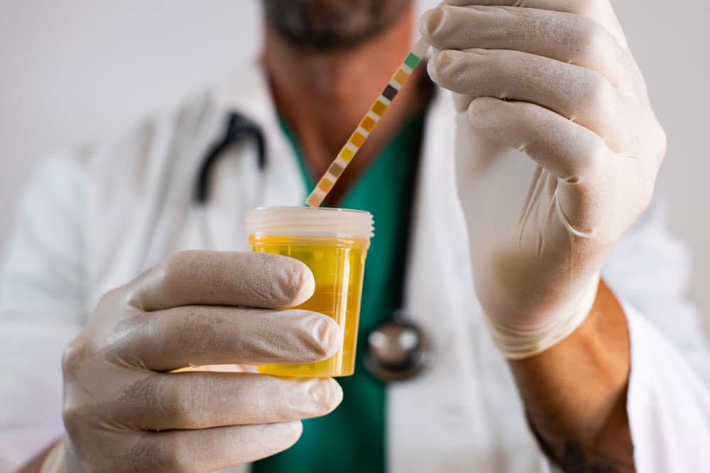 Physician checking urine sample