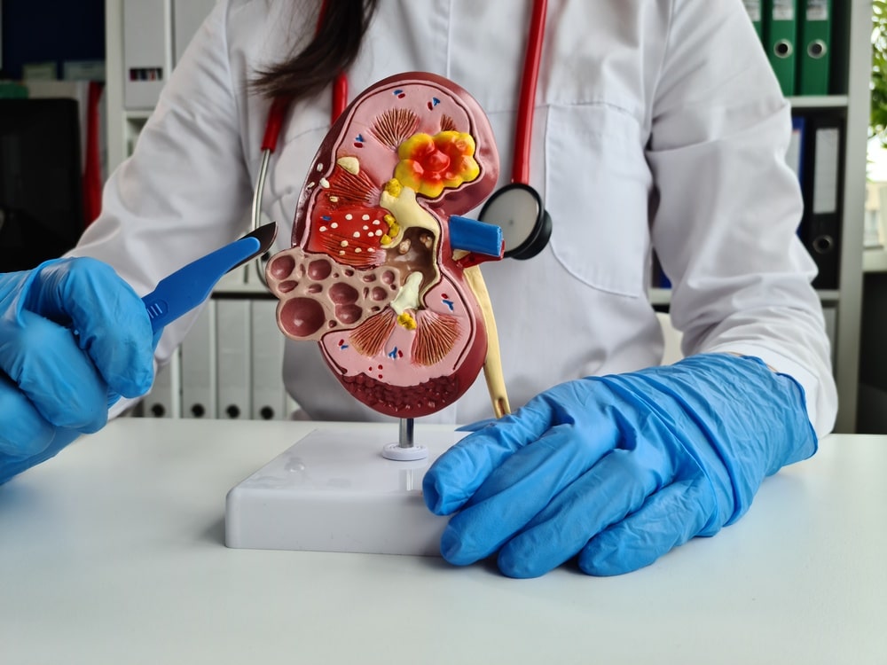 surgeon with gloves and scalpel showing model of kidney